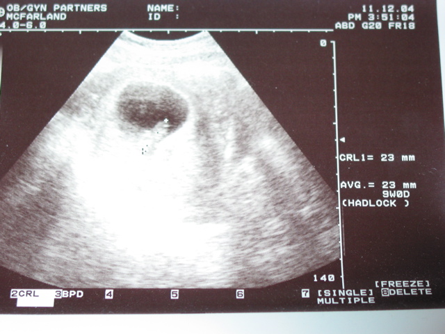 Having a blast at 9 weeks