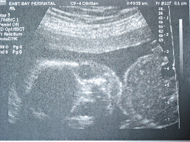 Not quite as cute at 20 weeks