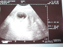 Having a blast at 9 weeks