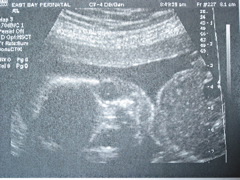 Not quite as cute at 20 weeks